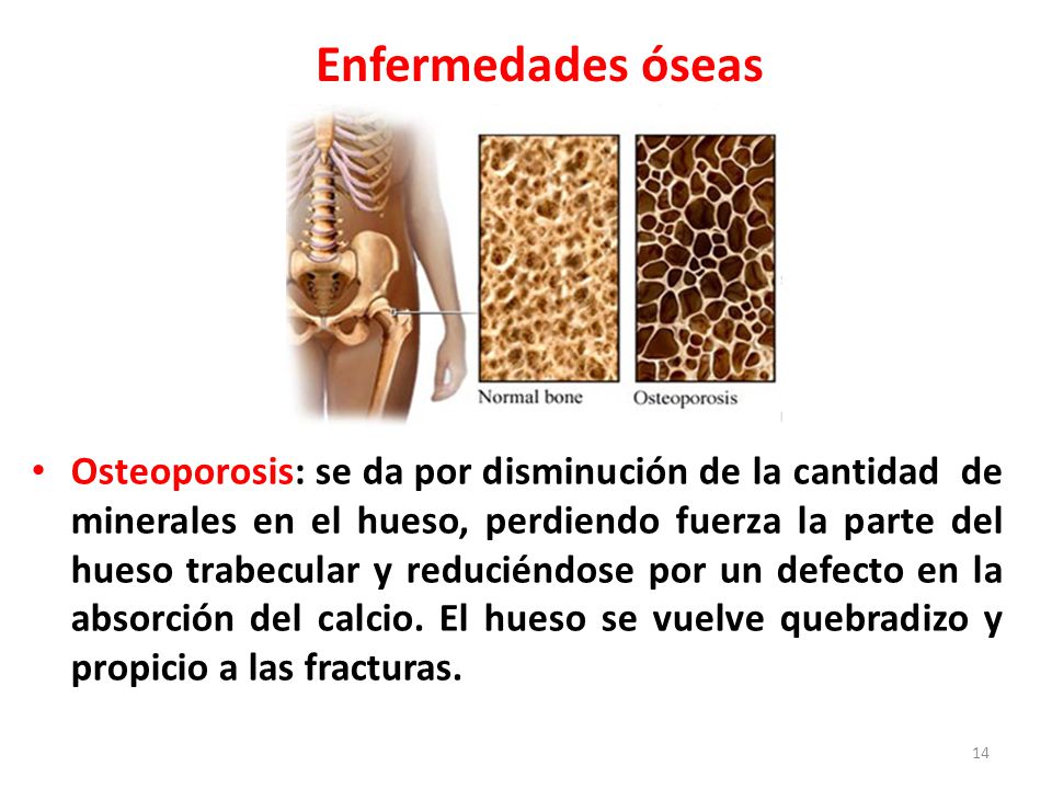 Como adelgazar en la parte interior de la cadera el régimen